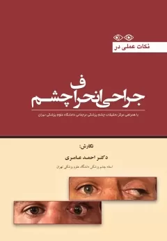 کتاب الکترونیک نکات عملی در جراحی انحراف چشم